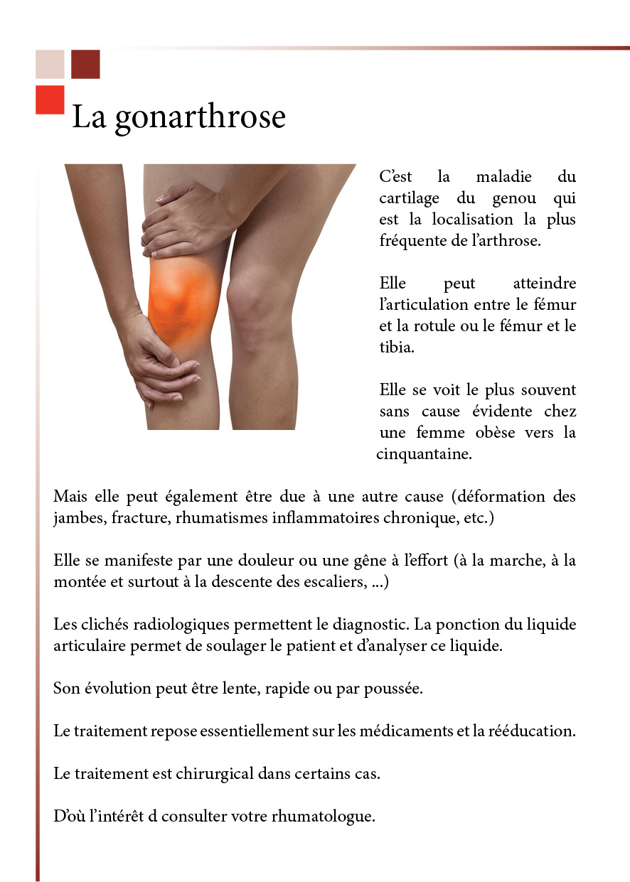 1 La gonarthrose2016
