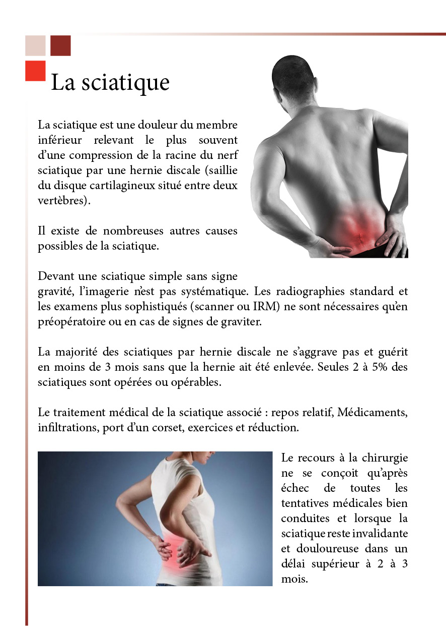 3La sciatique