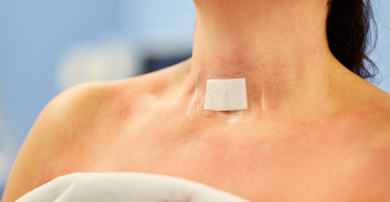 chirurgie thyroidienne 16072023 2